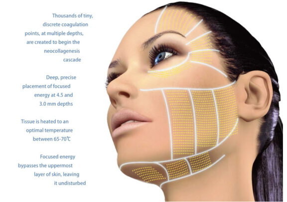 Skin rejuvenation Newcastle NSW