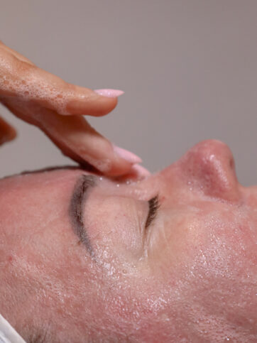 Dermal therapy in newcastle